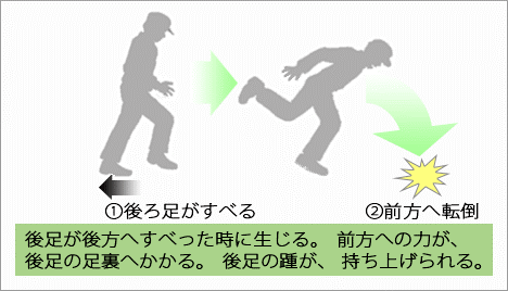 すべりによる前方・側方への転倒